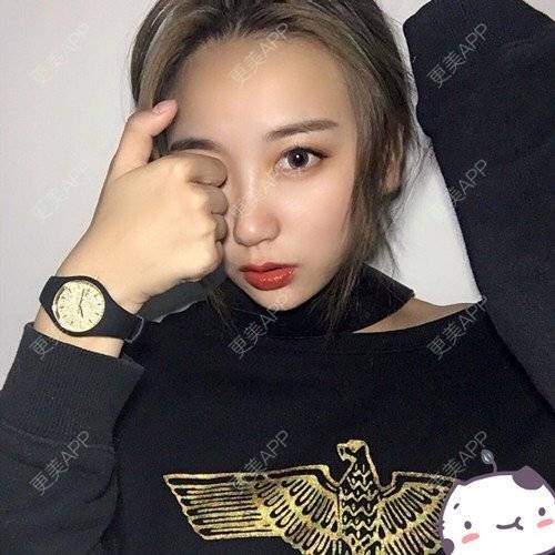更美 - 更美用户p2CNi7da5u的鼻部多项经验 | 鼻部多项 | 苏州 | 耳软骨隆鼻