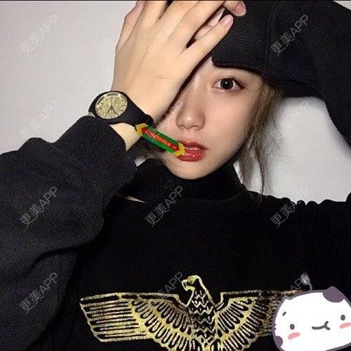 更美 - 更美用户p2CNi7da5u的鼻部多项经验 | 鼻部多项 | 苏州 | 耳软骨隆鼻