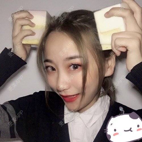 更美 - 更美用户p2CNi7da5u的鼻部多项经验 | 鼻部多项 | 苏州 | 耳软骨隆鼻