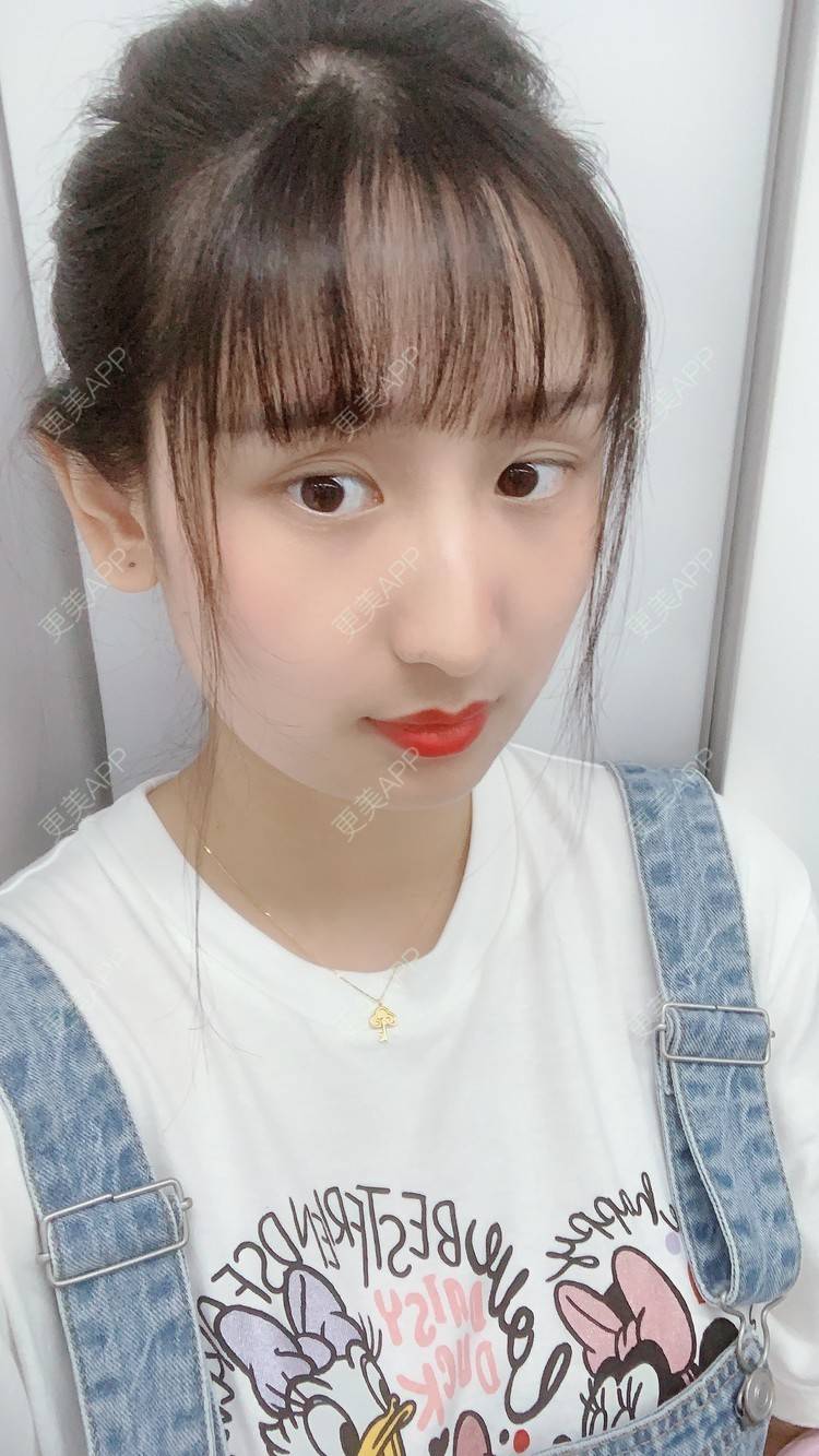 更美 - 深圳华厦眼科的全飞秒激光术经验 | 全飞秒激光术 | 深圳