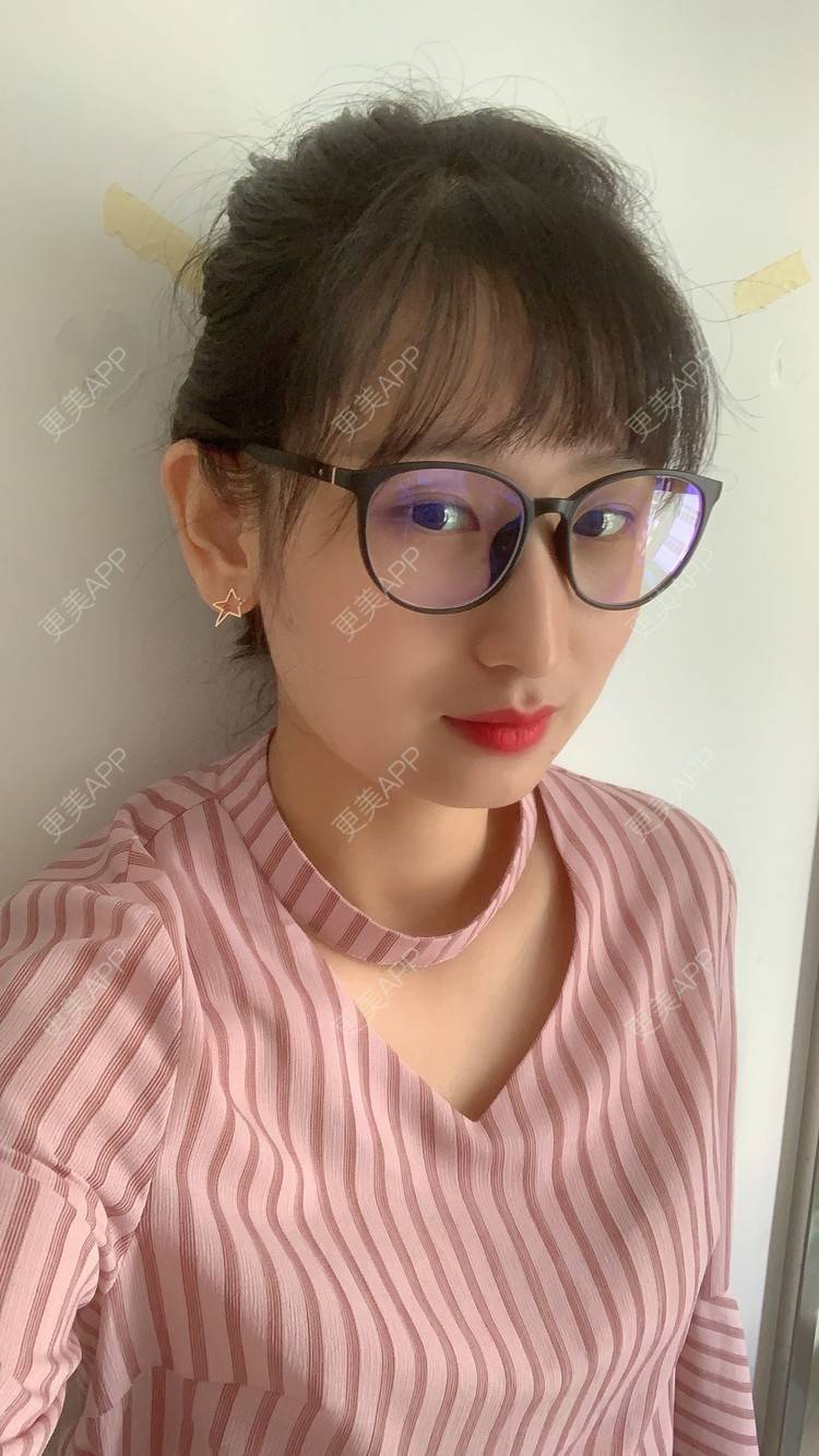 更美 - 深圳华厦眼科的全飞秒激光术经验 | 全飞秒激光术 | 深圳