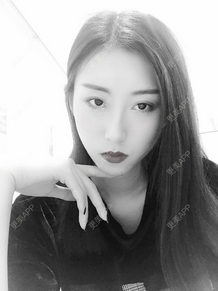 更美 - 李桥莲 医生的鼻翼缩小经验 | 视频日记 | 鼻翼缩小 | 泉州