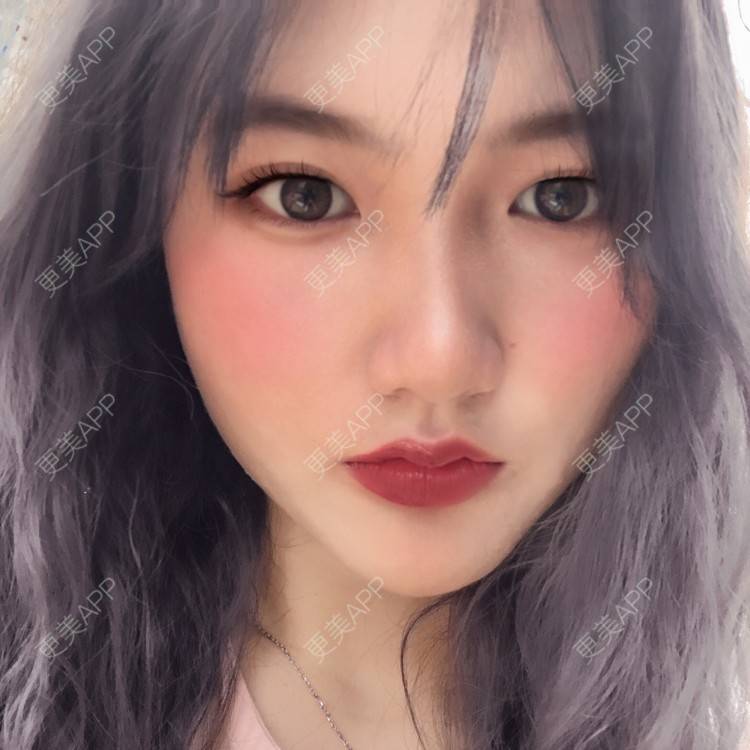 更美 - 男朋友是彭于晏的M唇成形经验 | M唇成形 | 杭州