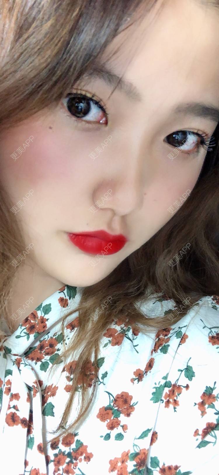 更美 - 男朋友是彭于晏的M唇成形经验 | M唇成形 | 杭州