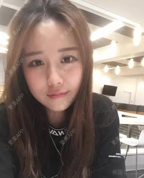 更美 - 更美用户QBJQzsiTV2的性腺激活经验 | 性腺激活