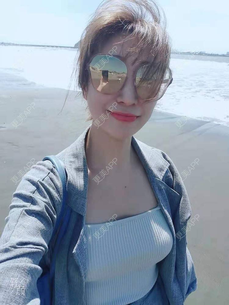 假体隆胸效果图_韩好甜假体隆胸效果图_术后340天__更美