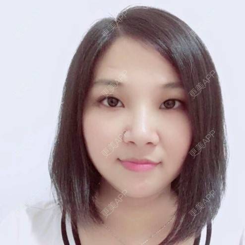 更美 - 深圳华厦眼科的准分子激光原位角膜磨镶术经验 | 准分子激光原位角膜磨镶术 | 深圳