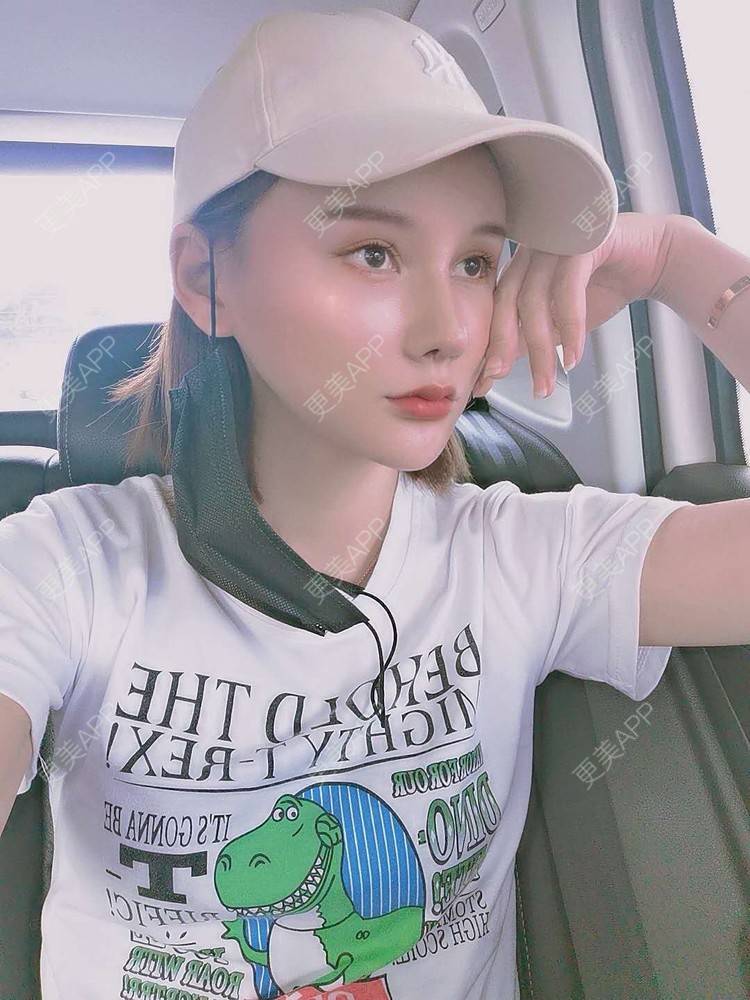 更美 - 上海爱度医疗美容门诊部的隆鼻经验 | 隆鼻 | 耳软骨隆鼻 | 硅胶隆鼻 | 鼻中隔软骨隆鼻