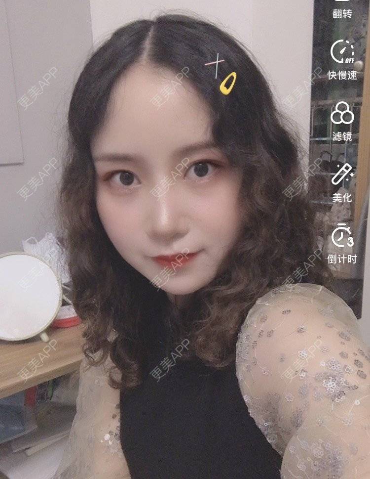更美 - 圆方脸课代表ʚ😊ɞ的隆鼻经验 | 玻尿酸卧蚕 | 鼻部多项 | 假体垫鼻基底 | 吸脂瘦大腿 | 全飞秒激光术 | 隆鼻 | 全切双眼皮 | 开内眼角 | 自体软骨垫鼻尖 | 硅胶隆鼻 | 南京 | 耳软骨隆鼻 | 视频日记