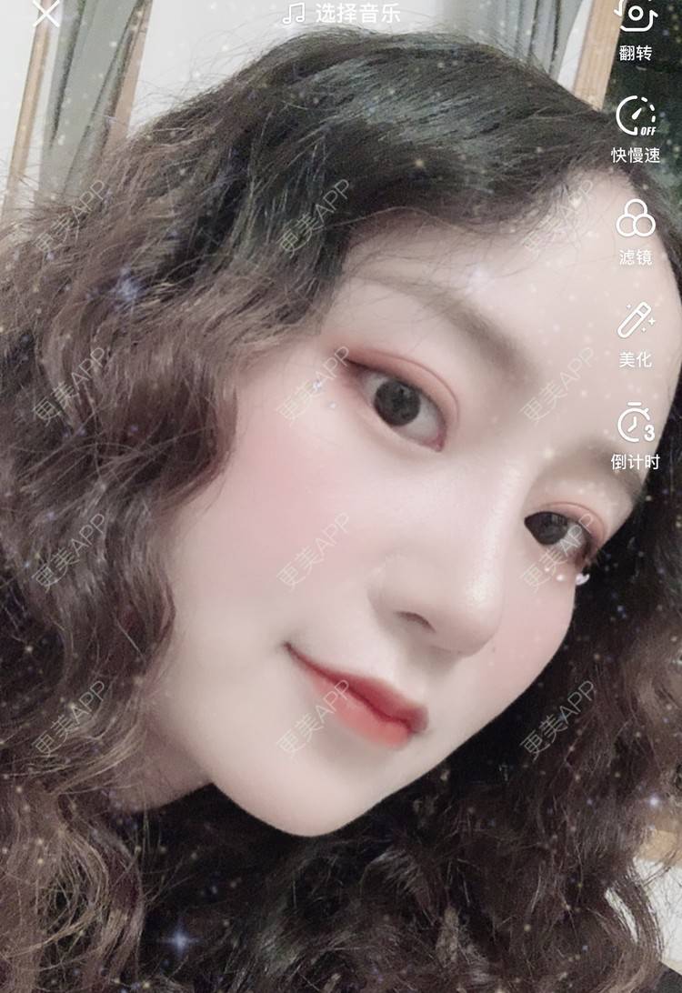 更美 - 圆方脸课代表ʚ😊ɞ的隆鼻经验 | 玻尿酸卧蚕 | 鼻部多项 | 假体垫鼻基底 | 吸脂瘦大腿 | 全飞秒激光术 | 隆鼻 | 全切双眼皮 | 开内眼角 | 自体软骨垫鼻尖 | 硅胶隆鼻 | 南京 | 耳软骨隆鼻 | 视频日记