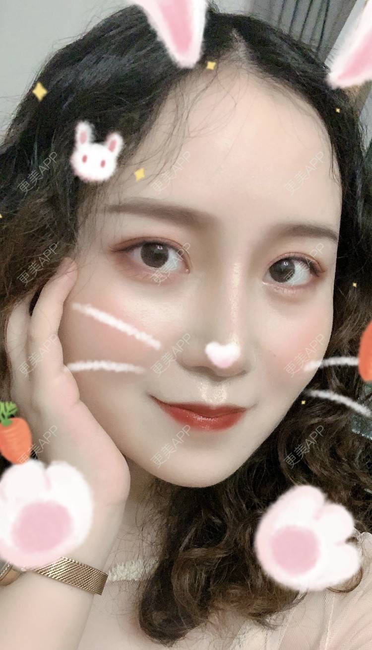 更美 - 圆方脸课代表ʚ😊ɞ的隆鼻经验 | 玻尿酸卧蚕 | 鼻部多项 | 假体垫鼻基底 | 吸脂瘦大腿 | 全飞秒激光术 | 隆鼻 | 全切双眼皮 | 开内眼角 | 自体软骨垫鼻尖 | 硅胶隆鼻 | 南京 | 耳软骨隆鼻 | 视频日记