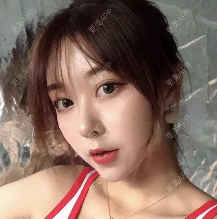 更美 - GBnm的硅胶垫下巴经验 | 硅胶垫下巴 | 南昌