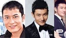 更美 - 长沙小叔叔的玻尿酸下巴经验 | 玻尿酸下巴 | 下巴截骨前移 | 自体脂肪垫下巴 | 硅胶垫下巴 | 膨体垫下巴