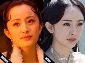 更美 - 长沙小叔叔的玻尿酸下巴经验 | 玻尿酸下巴 | 下巴截骨前移 | 自体脂肪垫下巴 | 硅胶垫下巴 | 膨体垫下巴