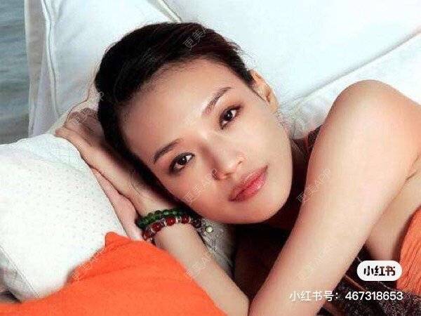 更美 - 长沙小叔叔的厚唇改薄经验 | 玻尿酸唇部 | 胶原蛋白丰唇 | 自体脂肪丰唇 | 厚唇改薄 | 长沙