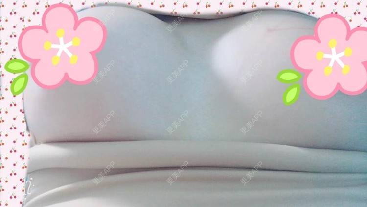 更美 - 更美用户TsqtLGm8wN的自体脂肪隆胸经验 | 自体脂肪隆胸 | 长沙