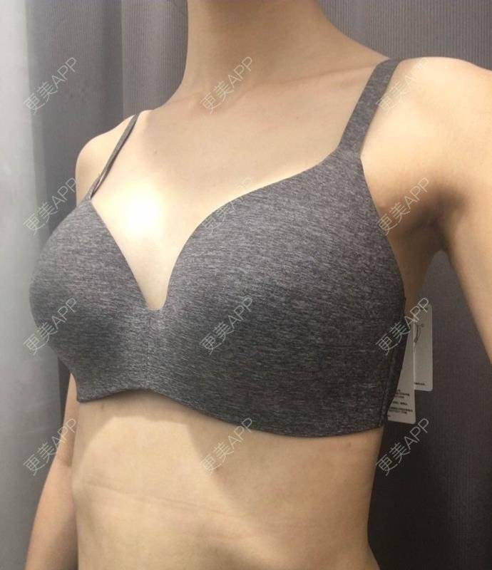 更美 - 更美用户TsqtLGm8wN的自体脂肪隆胸经验 | 自体脂肪隆胸 | 长沙