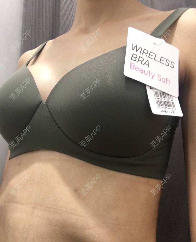 更美 - 更美用户TsqtLGm8wN的自体脂肪隆胸经验 | 自体脂肪隆胸 | 长沙