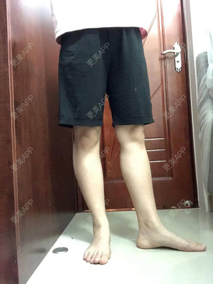 更美 - 我会用心聆听的除皱瘦脸经验 | 腿部塑形 | 除皱瘦脸 | 广州