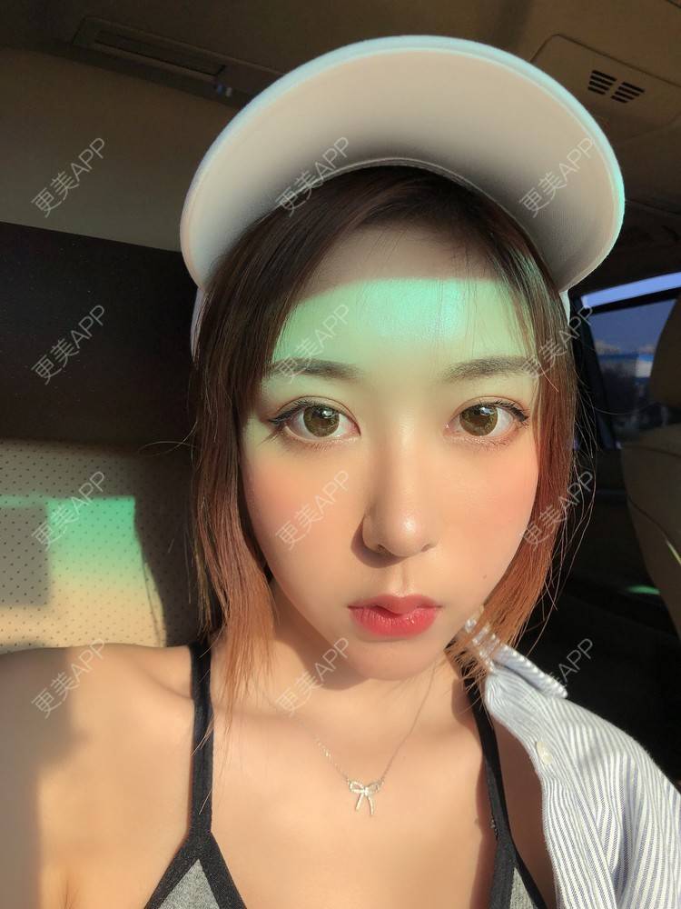 更美 - 薄情人゜缓的M唇成形经验 | M唇成形 | 武汉
