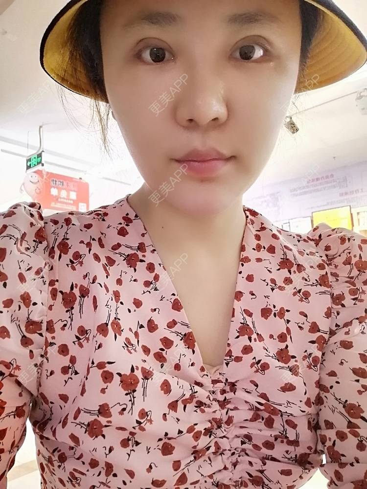 更美 - 静静子子的鼻部多项经验 | 鼻部多项 | 首尔