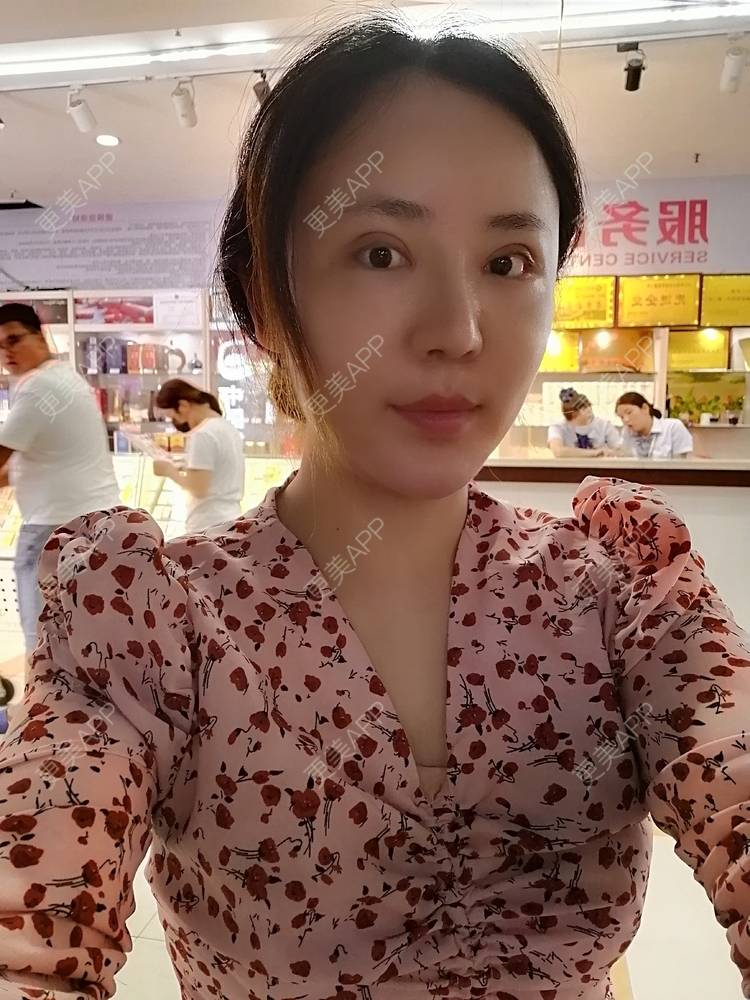 更美 - 静静子子的鼻部多项经验 | 鼻部多项 | 首尔