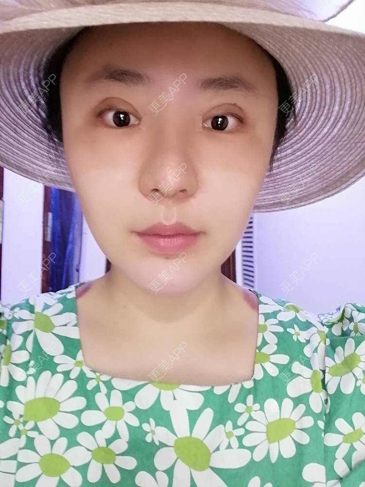 更美 - 静静子子的鼻部多项经验 | 鼻部多项 | 首尔