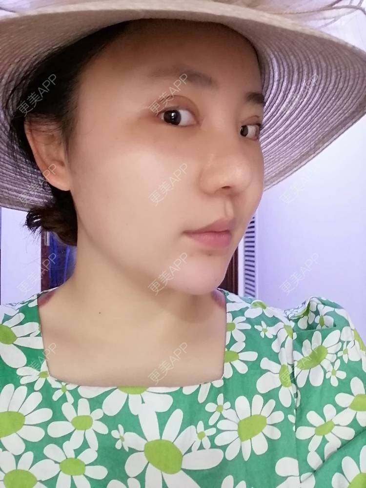 更美 - 静静子子的鼻部多项经验 | 鼻部多项 | 首尔