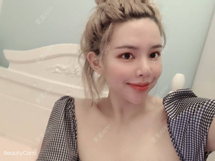 更美 - 花朵米特的除皱瘦脸经验 | 除皱瘦脸 | 上海