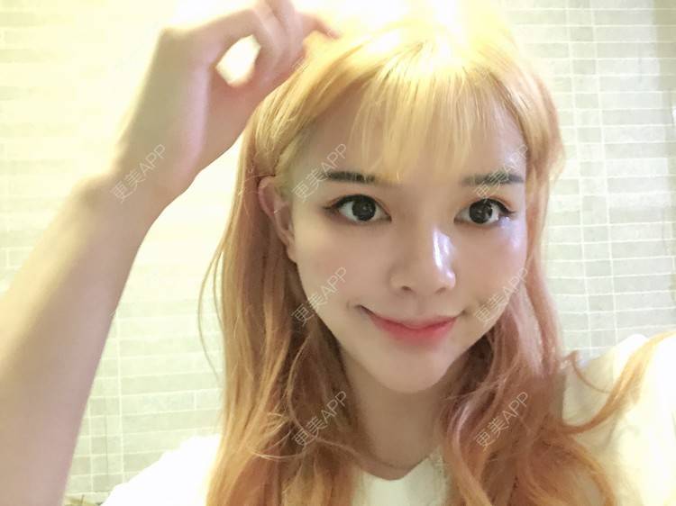 更美 - 花朵米特的除皱瘦脸经验 | 除皱瘦脸 | 上海