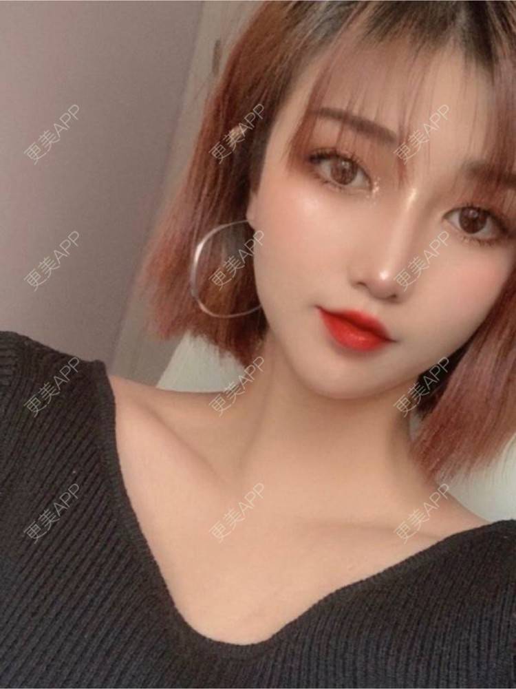 更美 - 重庆军科整形美容医院的鼻部多项经验 | 鼻部多项 | 重庆