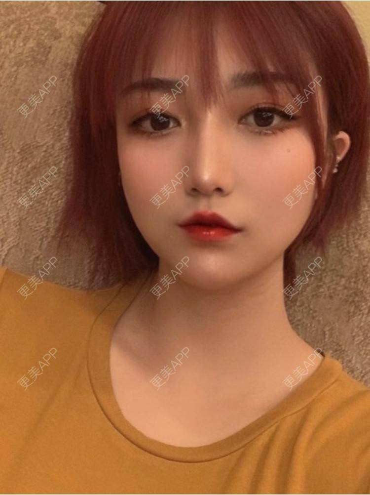 更美 - 重庆军科整形美容医院的鼻部多项经验 | 鼻部多项 | 重庆