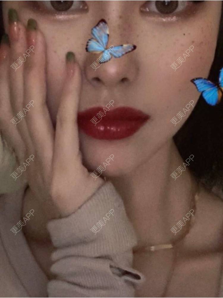 更美 - 重庆军科整形美容医院的鼻部多项经验 | 鼻部多项 | 重庆