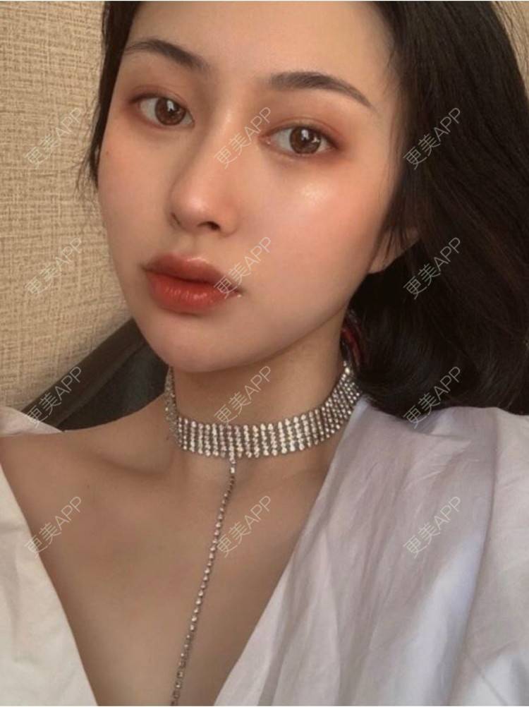 更美 - 重庆军科整形美容医院的鼻部多项经验 | 鼻部多项 | 重庆