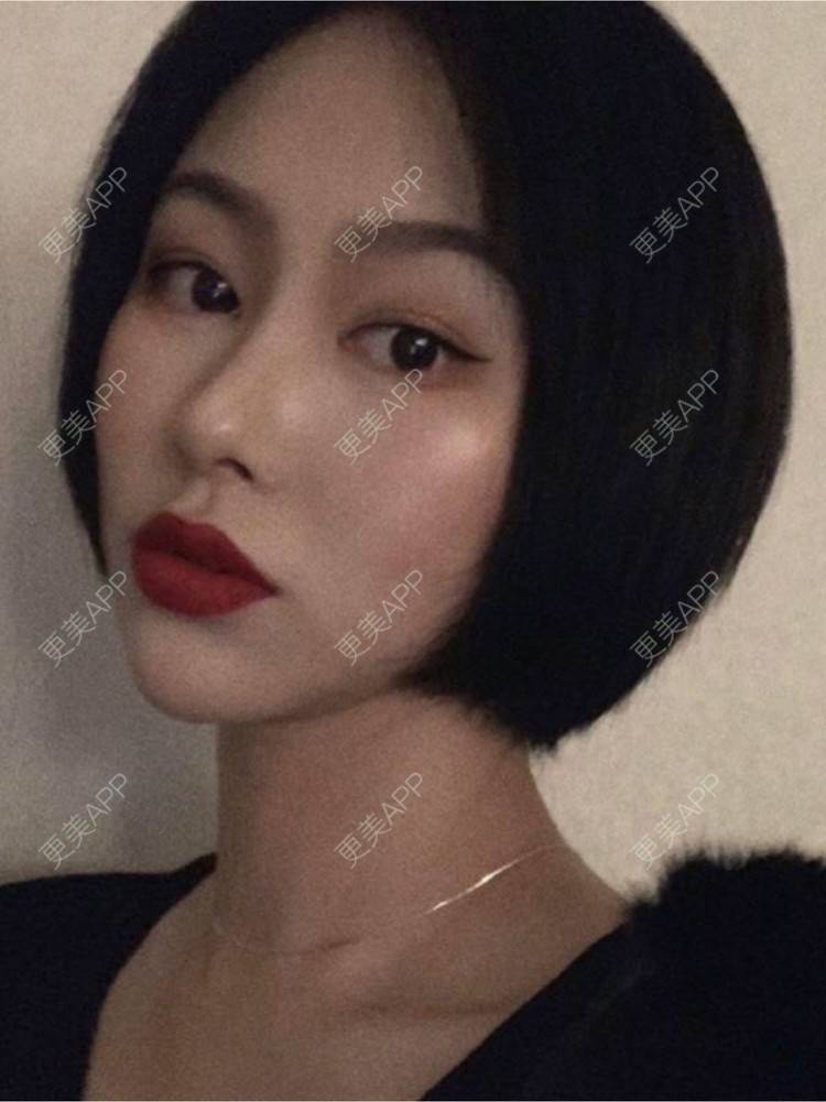 更美 - 重庆军科整形美容医院的鼻部多项经验 | 鼻部多项 | 重庆