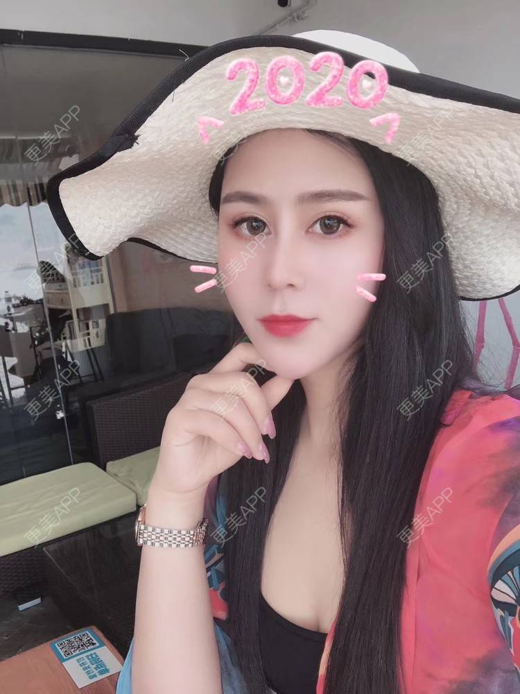 更美 - 更美用户zwQN5e8jIh的鼻部多项经验 | 鼻部多项 | 长沙