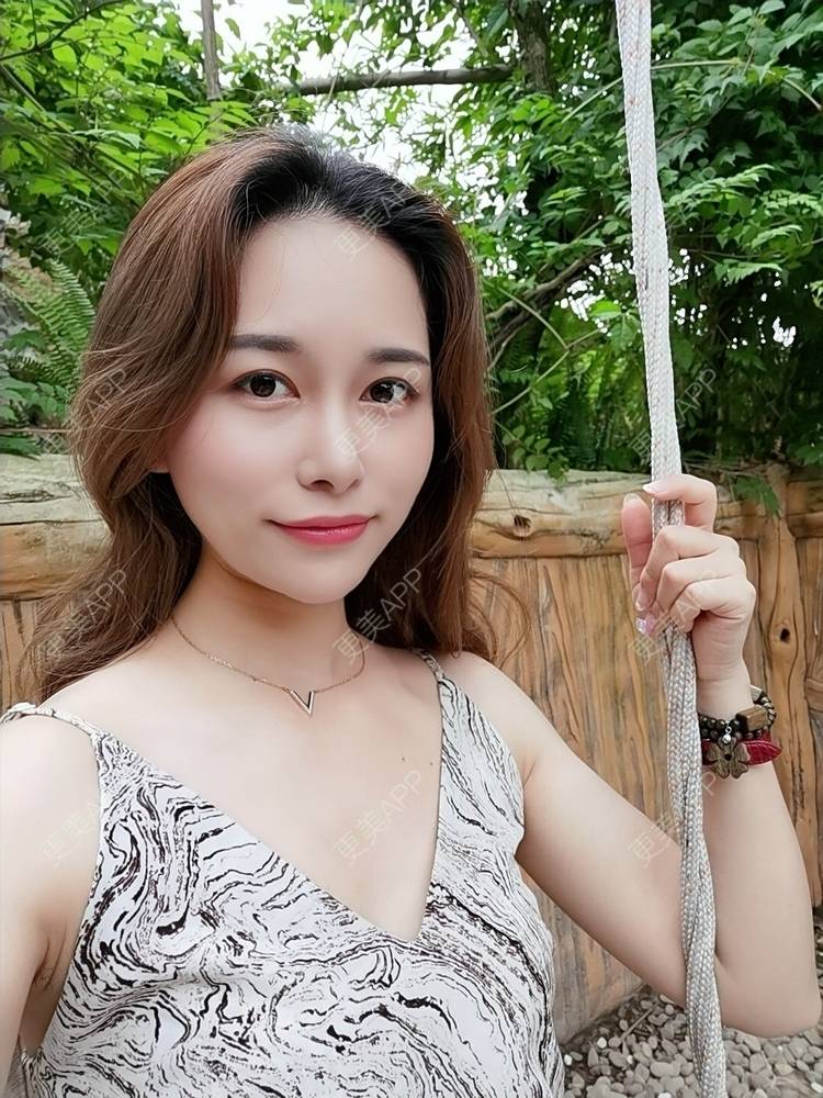 更美 - 甜心泡芙的双眼皮修复经验 | 双眼皮 | 全切双眼皮 | 开内眼角 | 重庆 | 双眼皮修复