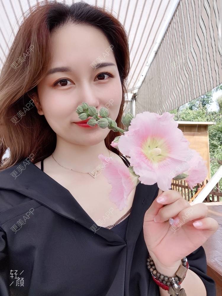 更美 - 甜心泡芙的双眼皮修复经验 | 双眼皮 | 全切双眼皮 | 开内眼角 | 重庆 | 双眼皮修复