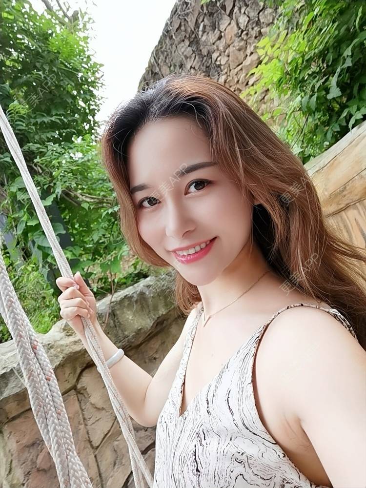 更美 - 甜心泡芙的双眼皮修复经验 | 双眼皮 | 全切双眼皮 | 开内眼角 | 重庆 | 双眼皮修复