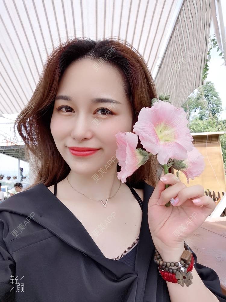 更美 - 甜心泡芙的双眼皮修复经验 | 双眼皮 | 全切双眼皮 | 开内眼角 | 重庆 | 双眼皮修复