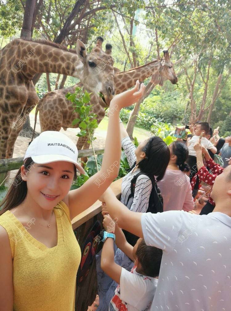 更美 - Imiss you的宽下巴矫正经验 | 自体脂肪垫下巴 | 硅胶垫下巴 | 膨体垫下巴 | 玻尿酸下巴 | 下巴截骨前移 | 宽下巴矫正 | 自体脂肪丰太阳穴 | 硅胶丰太阳穴 | 膨体丰太阳穴 | 成都 | 人工骨垫下巴