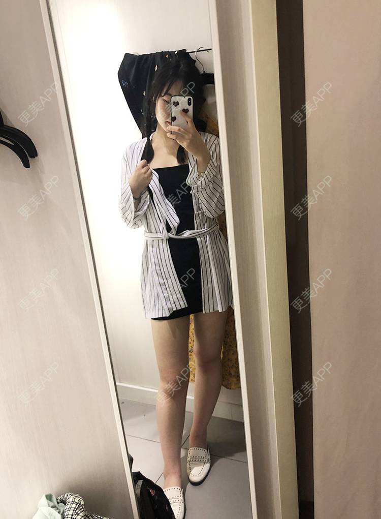 吸脂瘦大腿前后对比照_更美用户spswzgy9ye吸脂瘦大腿前后对比照_术后