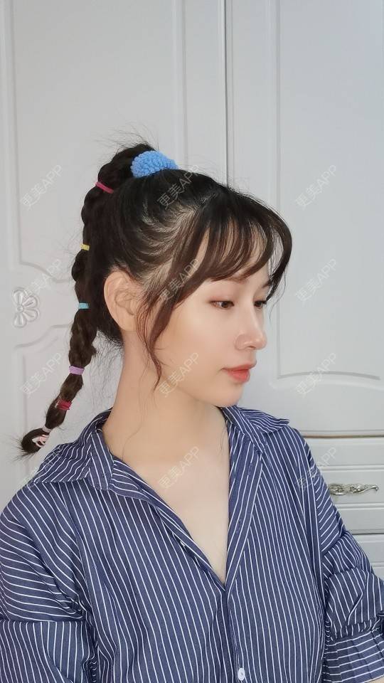 更美 - Sarah龙锦er🇨🇳的吸脂瘦脸经验 | 吸脂瘦脸 | 武汉