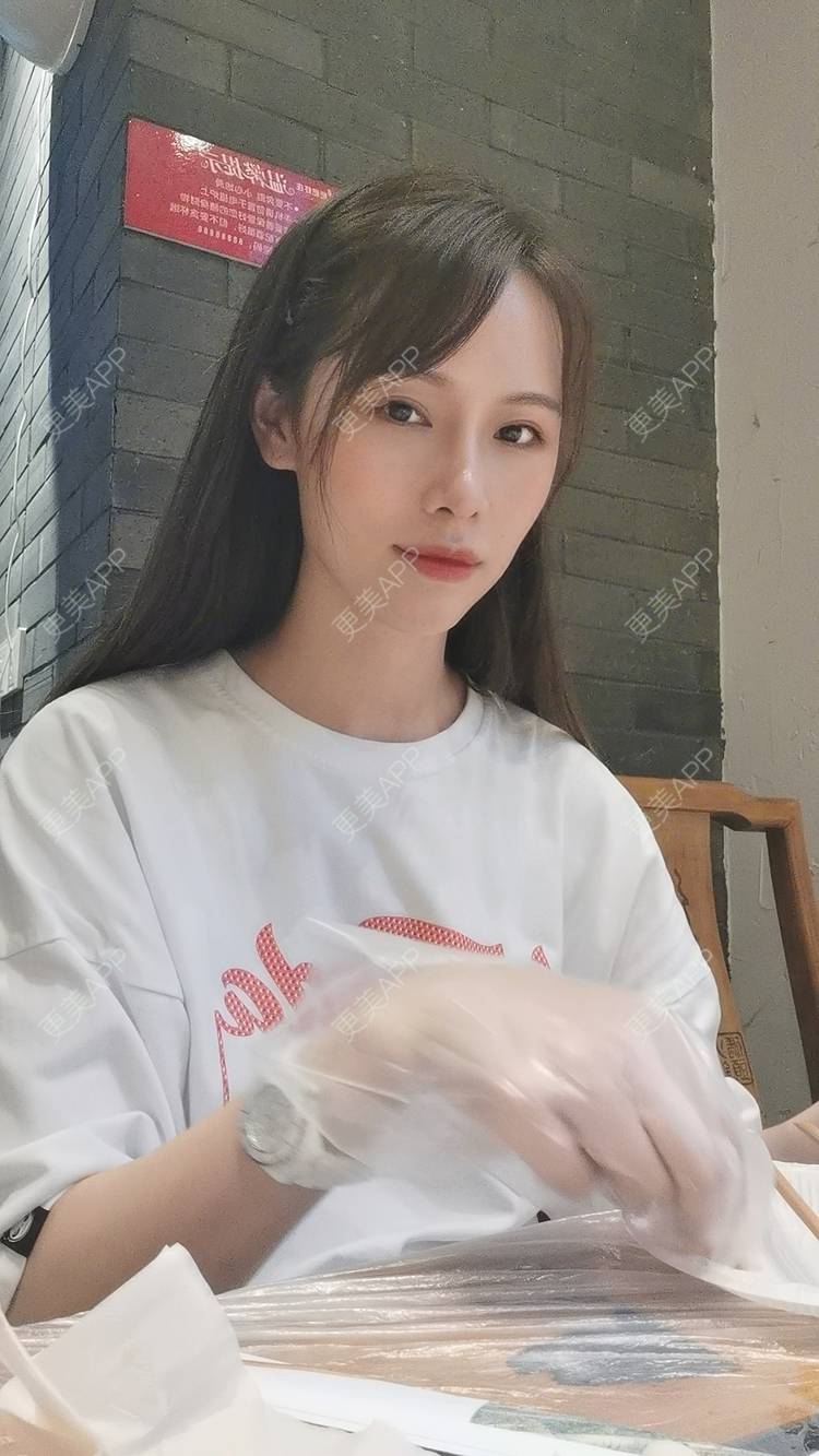 更美 - Sarah龙锦er🇨🇳的吸脂瘦脸经验 | 吸脂瘦脸 | 武汉