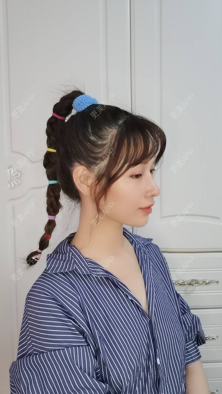更美 - Sarah龙锦er🇨🇳的吸脂瘦脸经验 | 吸脂瘦脸 | 武汉