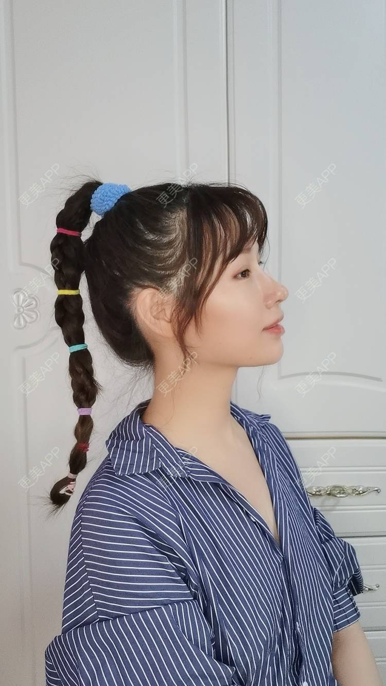 更美 - Sarah龙锦er🇨🇳的吸脂瘦脸经验 | 吸脂瘦脸 | 武汉