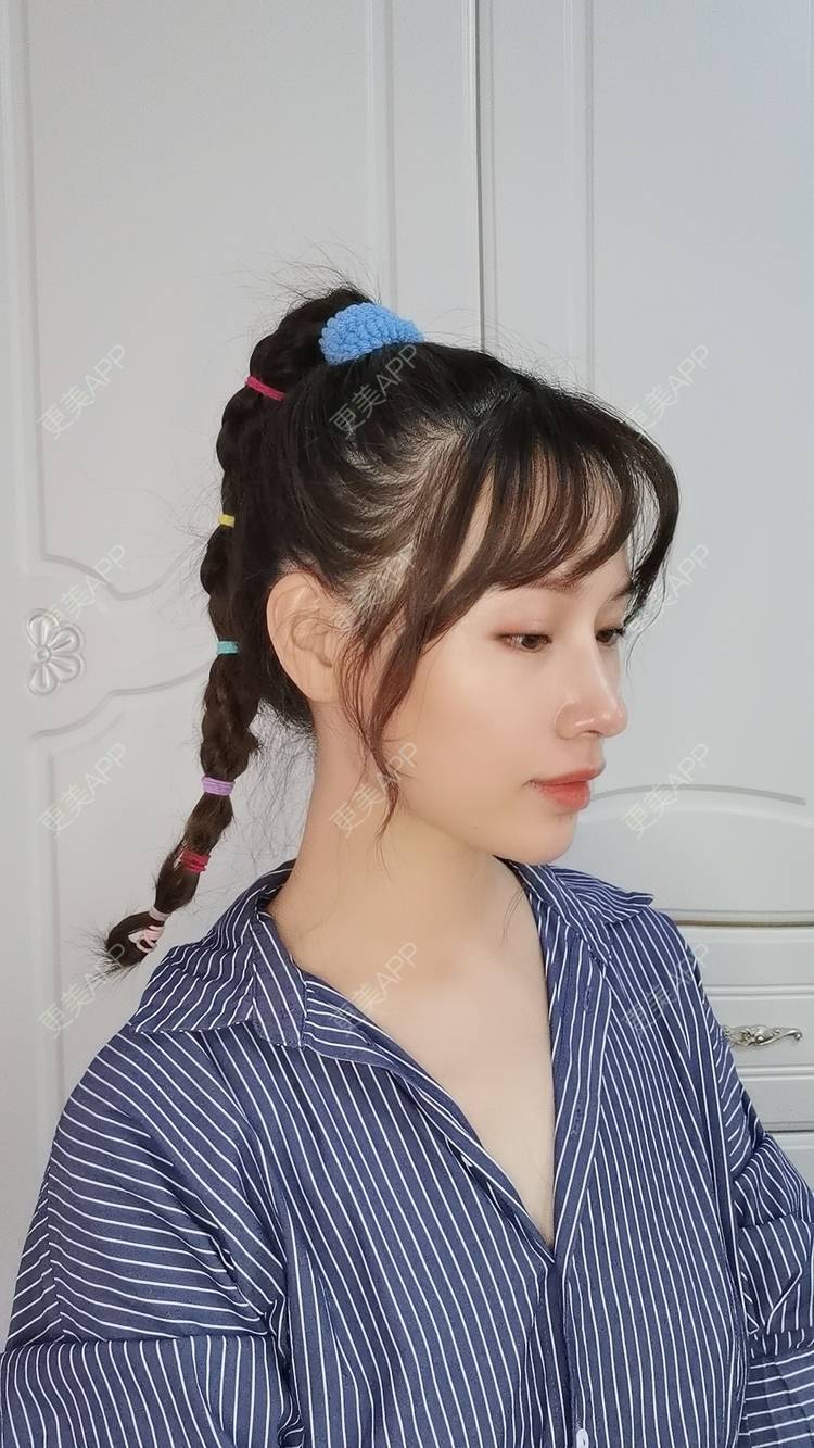 更美 - Sarah龙锦er🇨🇳的吸脂瘦脸经验 | 吸脂瘦脸 | 武汉