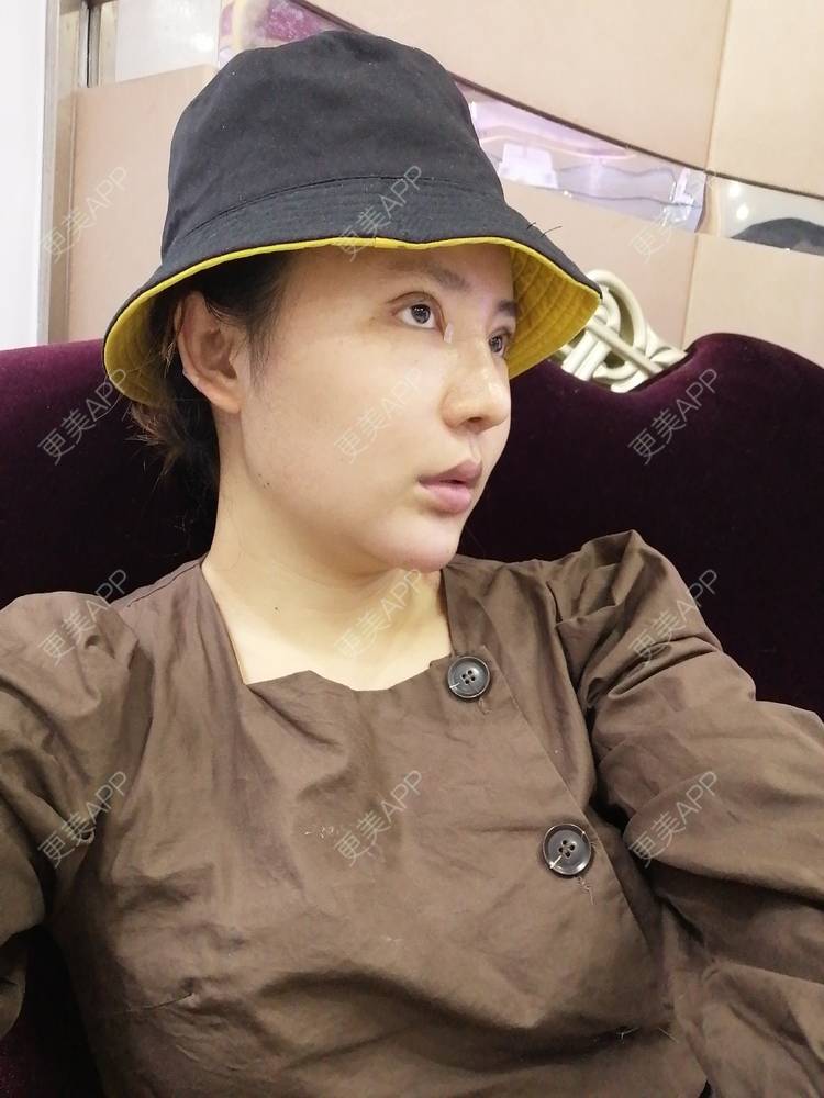 更美 - 静静子子的鼻部多项经验 | 鼻部多项 | 首尔