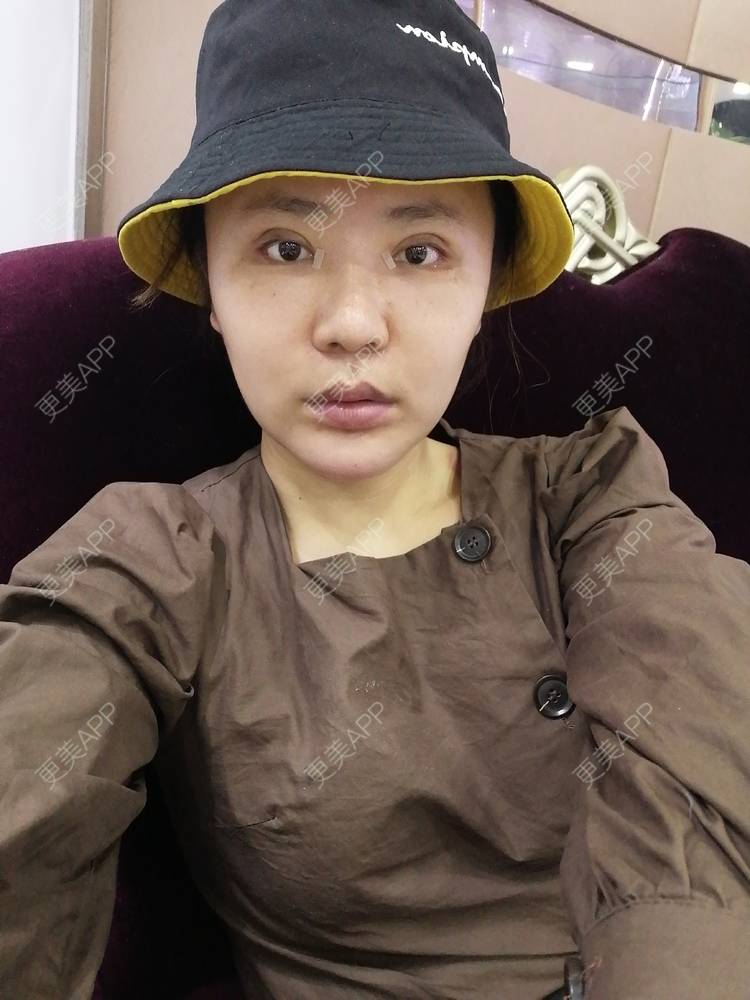 更美 - 静静子子的鼻部多项经验 | 鼻部多项 | 首尔