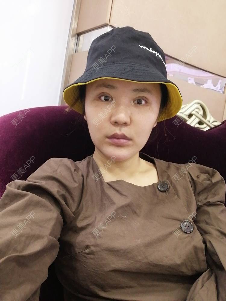 更美 - 静静子子的鼻部多项经验 | 鼻部多项 | 首尔